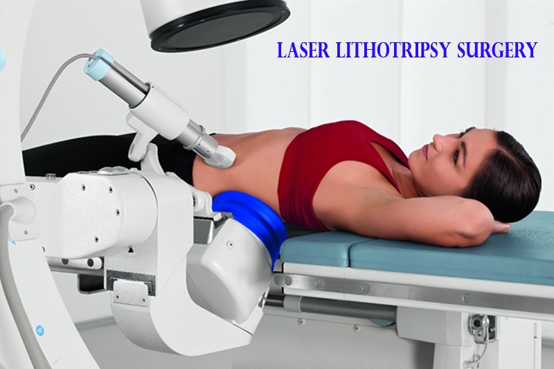 Lithotripsy laser surgery in Adelaide