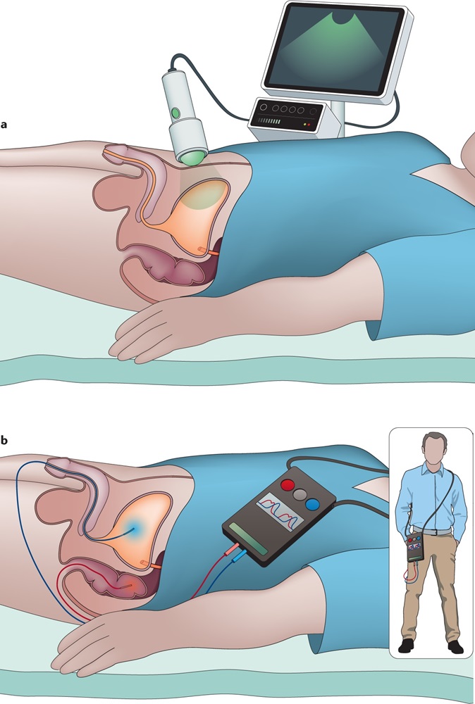 Urodynamic Computer testing
